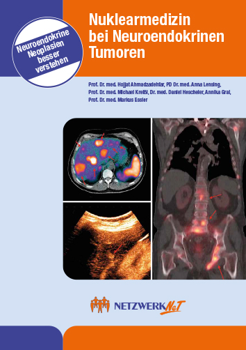 NukMed-Behandlung_Titel Thumbnail